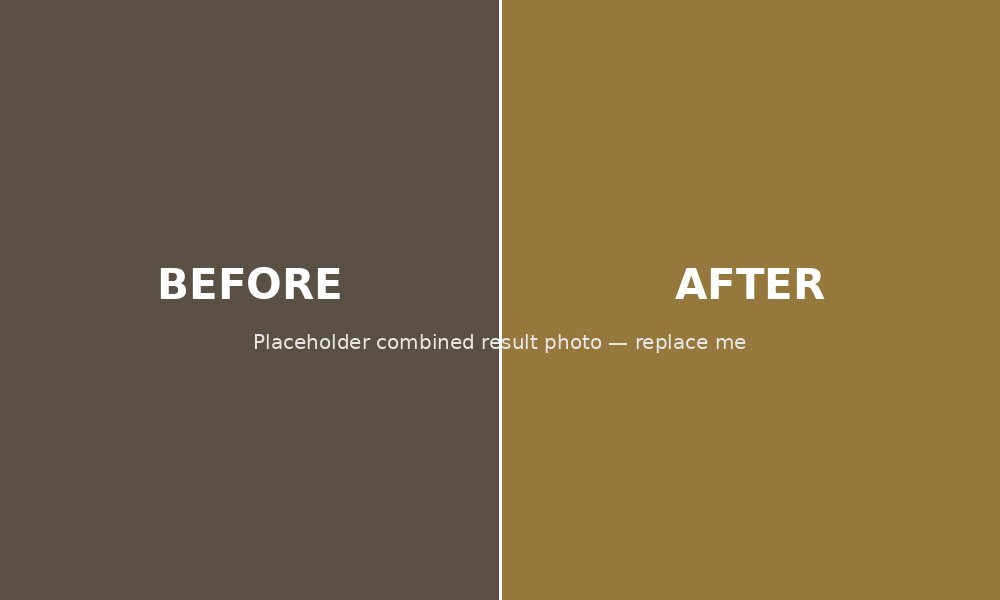 Diode Laser — before and after result
